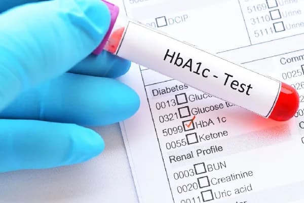 HbA1c (3-Month Sugar Test)