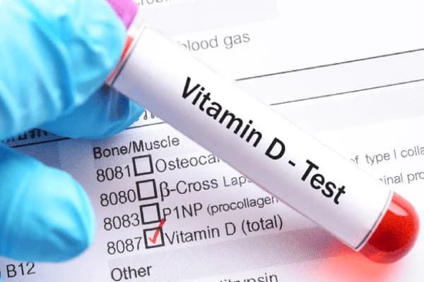 Vitamin D Test